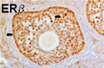 Mouse Ovary